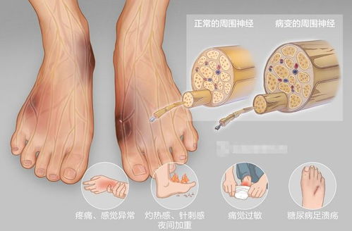 25������25�������򲡻��ܻ���