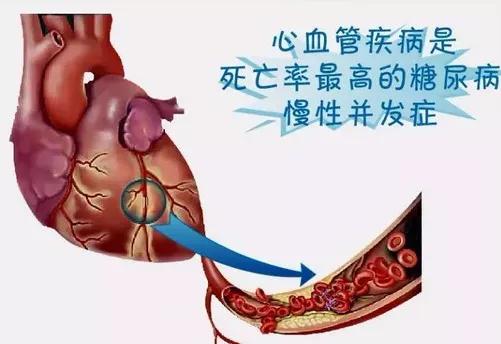 长期慢性糖尿病的问诊 长期慢性糖尿病的问诊