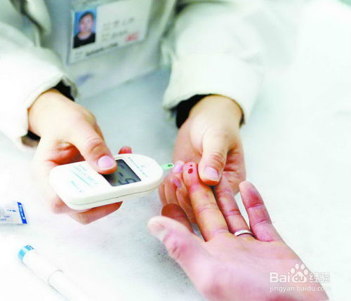 糖尿病舌像 糖尿病舌像图 糖尿病舌像 糖尿病舌像图