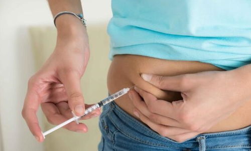 ʹ���ȵ��ص�4��ע������