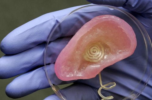 2型糖尿病病因有哪些 2型糖尿病发病机制 2型糖尿病病因有哪些 2型糖尿病发病机制