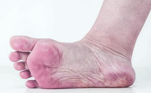 2�����ѽ��ǽ�֬������