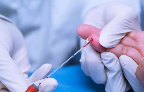 ���򲡵��˿ɺȷ�����