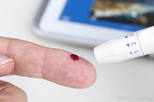 早上喝燕麦治疗糖尿病吗 早上喝燕麦治疗糖尿病吗