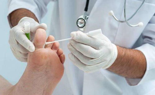 ���򲡲��˶�ò�Ѫ��׼