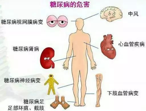 糖尿病轻微肾积水怎么办 糖尿病轻微肾积水怎么办