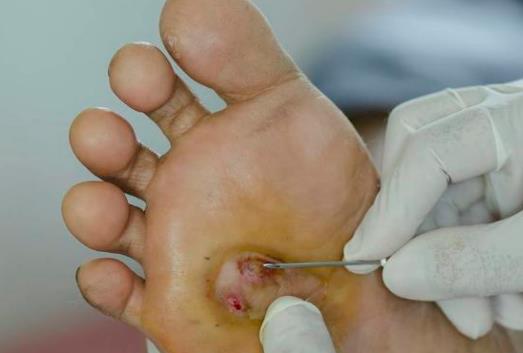 9�����򲡻���������������Ĥ���� ��η���