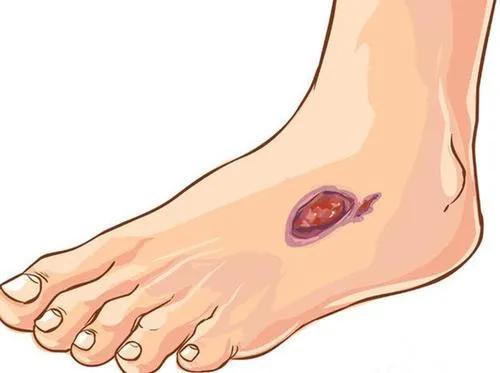 ���򲡿��Ժ�Ŧ������