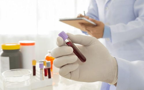 口干多尿是糖尿病吗 口干多尿是不是糖尿病 口干多尿是糖尿病吗 口干多尿是不是糖尿病