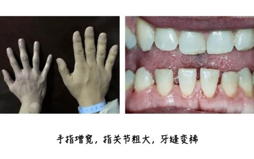 �����ȶ��˻᲻������