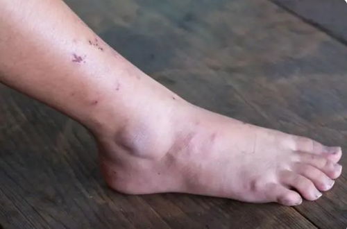 ���򲡻���Ƥ������4��������