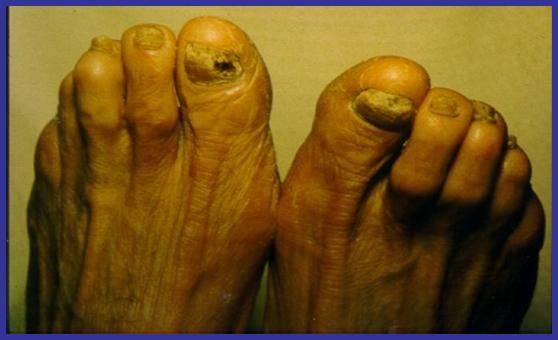 �����糿��ʲô�����