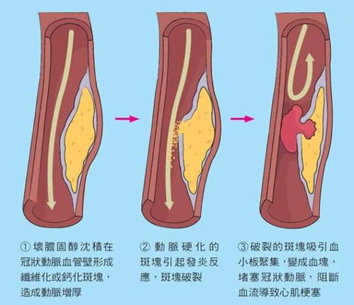 ������ ������ʲô����֢״����� 