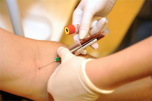 北京李晟的豪宅在哪里 北京李晟的豪宅在哪里