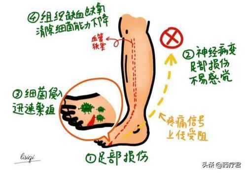 򲡳ԻɢƬ(ɢƬ̼θ)