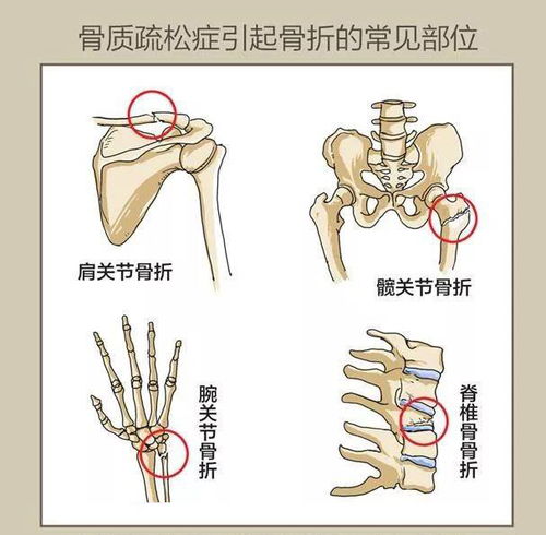 �����ȵ��ر�Ҫ�ű����� �������챣���ȵ���ȫ��