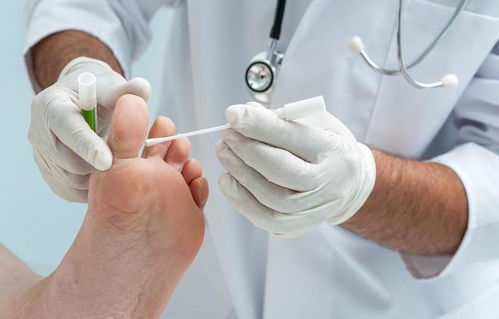 黄芪胶囊治疗糖尿病吗 黄芪胶囊治疗糖尿病吗